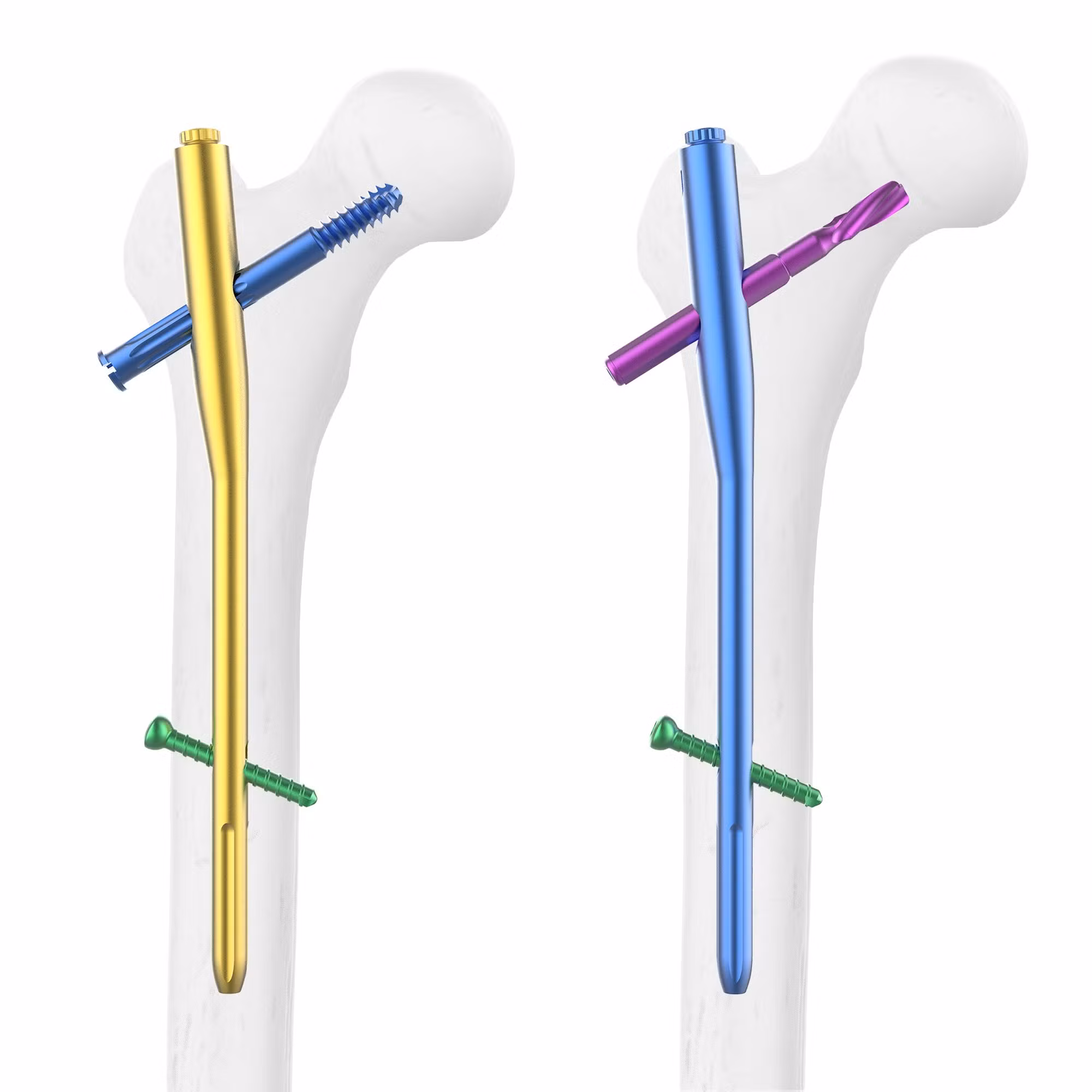 Chirurgie orthopédique